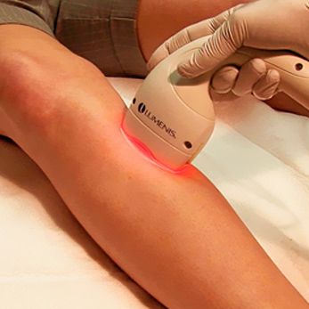 Quintana Doctors depilación de pierna